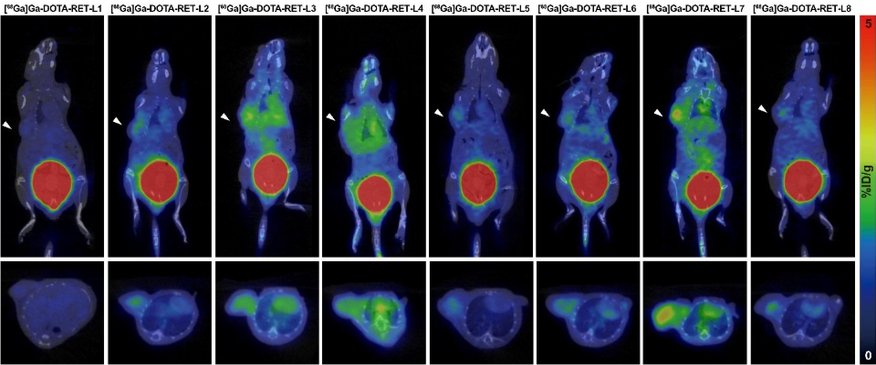 RET-targeted PET tracer highlights neuroendocrine prostate cancer tumors. Representative PET imaging shows strong tumor uptake of the RET-binding peptide tracer [⁶⁸Ga]Ga-DOTA-RET-L7 in a neuroendocrine prostate cancer (NEPC) model, supporting highly specific, high-contrast detection.