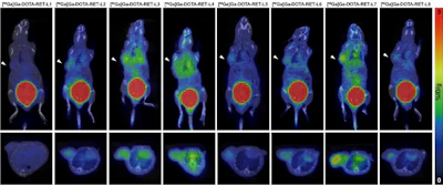 RET-targeted PET tracer highlights neuroendocrine prostate cancer tumors. Representative PET imaging shows strong tumor uptake of the RET-binding peptide tracer [⁶⁸Ga]Ga-DOTA-RET-L7 in a neuroendocrine prostate cancer (NEPC) model, supporting highly specific, high-contrast detection.