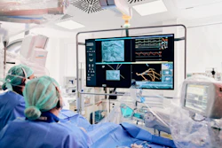 The combination of Syngo.CT Coronary Cockpit and Syngo PCI Connect gives interventional cardiologists valuable insights on morphology, plaque and lesion details and allows for strategic planning of the intervention.