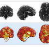 Representative 3D displacement maps of one subject (female, 24 years old) derived from aMRI. The top row shows the coronal, sagittal, and axial slices of a structural aMRI magnitude image for morphological context, while the bottom row shows displacement fields overlaid; greater pulsatility during the cardiac cycle is seen in areas surrounding the brainstem and cerebrospinal filled regions.