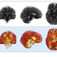 Representative 3D displacement maps of one subject (female, 24 years old) derived from aMRI. The top row shows the coronal, sagittal, and axial slices of a structural aMRI magnitude image for morphological context, while the bottom row shows displacement fields overlaid; greater pulsatility during the cardiac cycle is seen in areas surrounding the brainstem and cerebrospinal filled regions.
