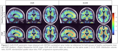 Lucas Narciso, PhD, and SNMMI