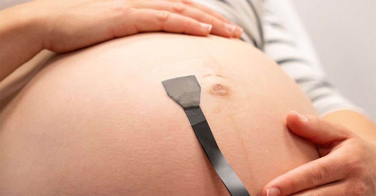 A wearable ultrasound patch could provide continuous monitoring of the fetus and umbilical cord during pregnancy.