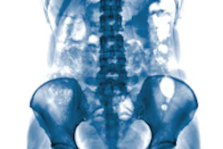 X Ray Abdomen