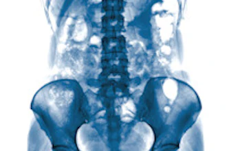 X Ray Abdomen