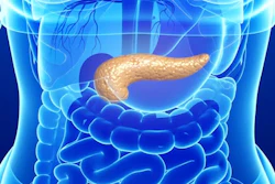Am 2018 03 06 00 04 4002 Pancreas New 400