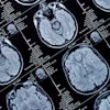 Am 2019 02 20 20 38 9544 Mri Brain Head 400
