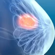 Breast Update 2 T76 Vuzvgq