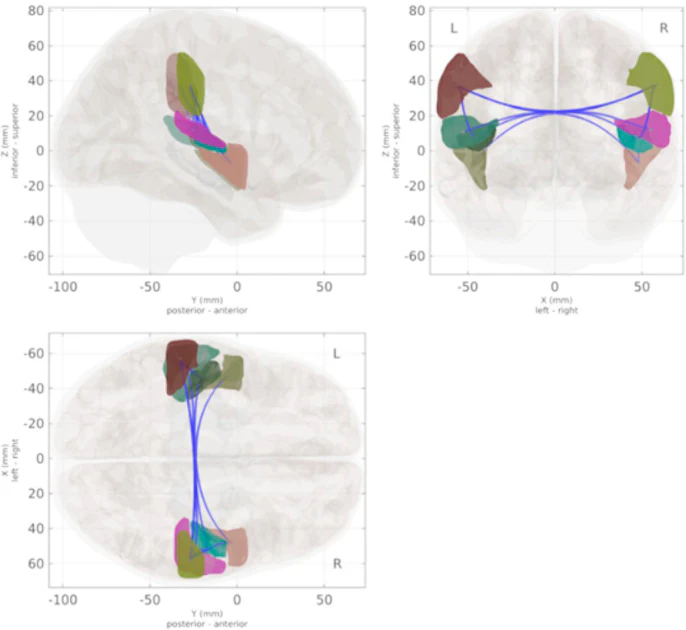 fMRI reveals postmenopausal brain connectivity shifts in midlife women