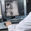 Dicom