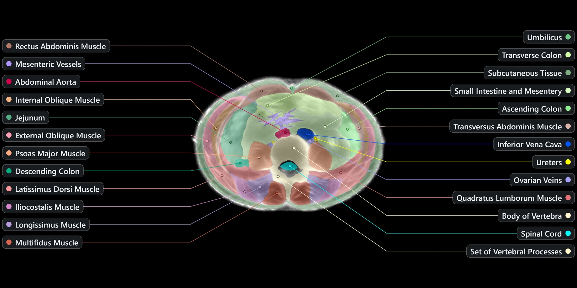 Example image from the Midjourney Scanner. Each slice continuously crossfades between the raw reconstruction and its AI segmentation.