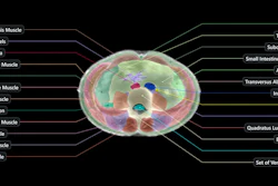 Example image from the Midjourney Scanner. Each slice continuously crossfades between the raw reconstruction and its AI segmentation.