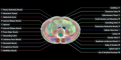 Example image from the Midjourney Scanner. Each slice continuously crossfades between the raw reconstruction and its AI segmentation.