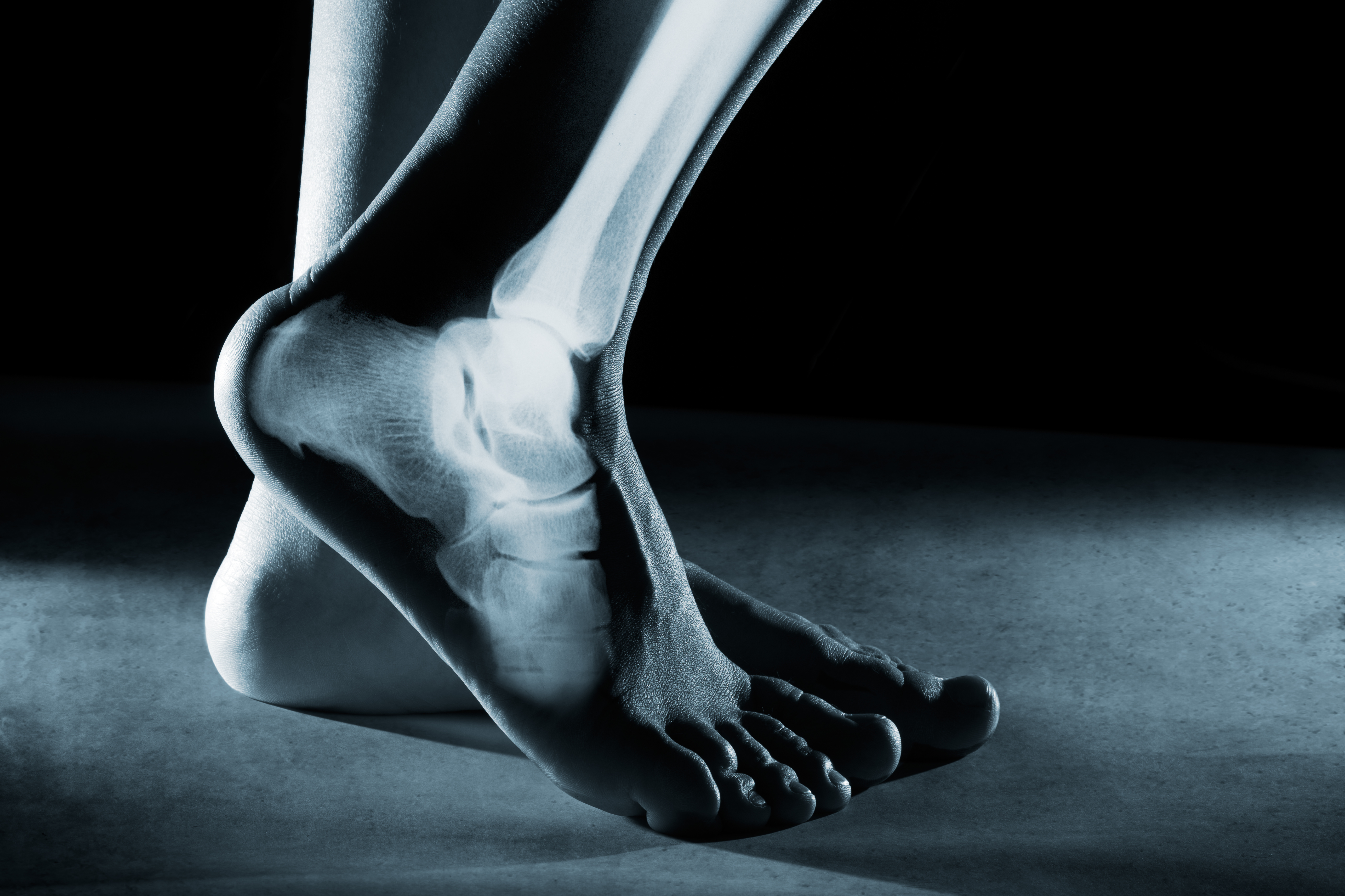 Foot Ankle