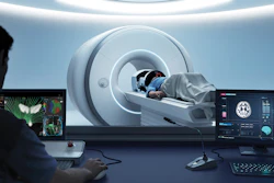 Insightec’s Exablate Neuro system delivers incisionless MR-guided focused ultrasound (MRgFUS) treatment for movement disorders, including Parkinson’s disease and essential tremor.