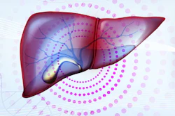 Liver Gallbladder 400 (1)
