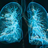 Lung 3 D Social