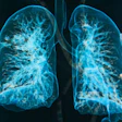Lung 3 D Social