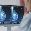 Mammogram Dense Breasts Cropped (1)