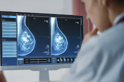Mammogram Dense Breasts Cropped (1)
