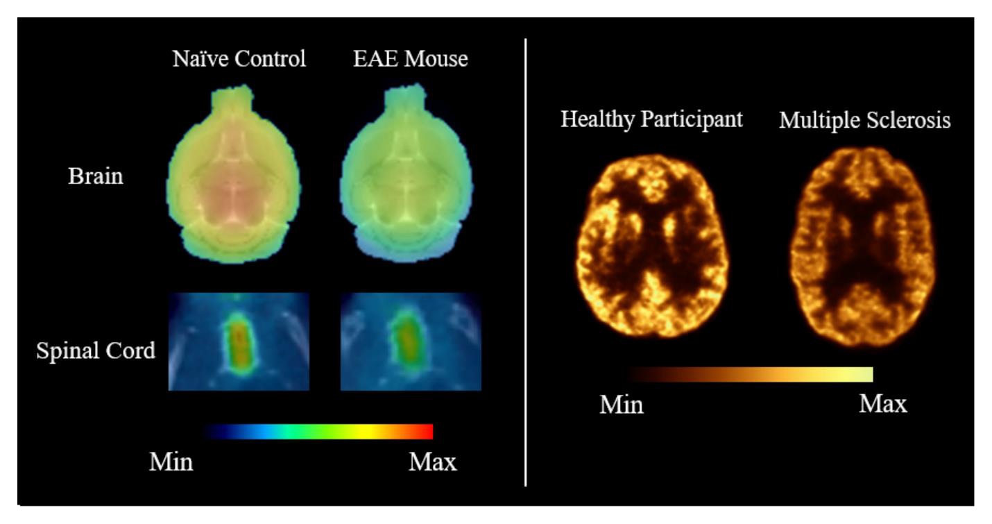 Representative SV2A PET images comparing synaptic density in healthy and disease states. The left panel shows F-18 SynVesT-1 PET distribution volume (VT) maps of the brain and spinal cord in a na&iuml;ve control mouse and a mouse with experimental autoimmune encephalomyelitis (EAE), a model of multiple sclerosis. The right panel shows Cu-11 UCB-J PET images of the brain of a 46-year-old male healthy control (left) and 43-year-old female MS patient (right).