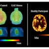 Representative SV2A PET images comparing synaptic density in healthy and disease states. The left panel shows F-18 SynVesT-1 PET distribution volume (VT) maps of the brain and spinal cord in a naïve control mouse and a mouse with experimental autoimmune encephalomyelitis (EAE), a model of multiple sclerosis. The right panel shows Cu-11 UCB-J PET images of the brain of a 46-year-old male healthy control (left) and 43-year-old female MS patient (right).