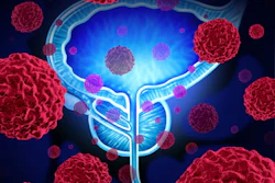 Prostate Cancer 400