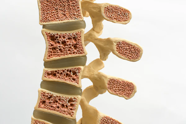 Spine Osteoporosis Leesle