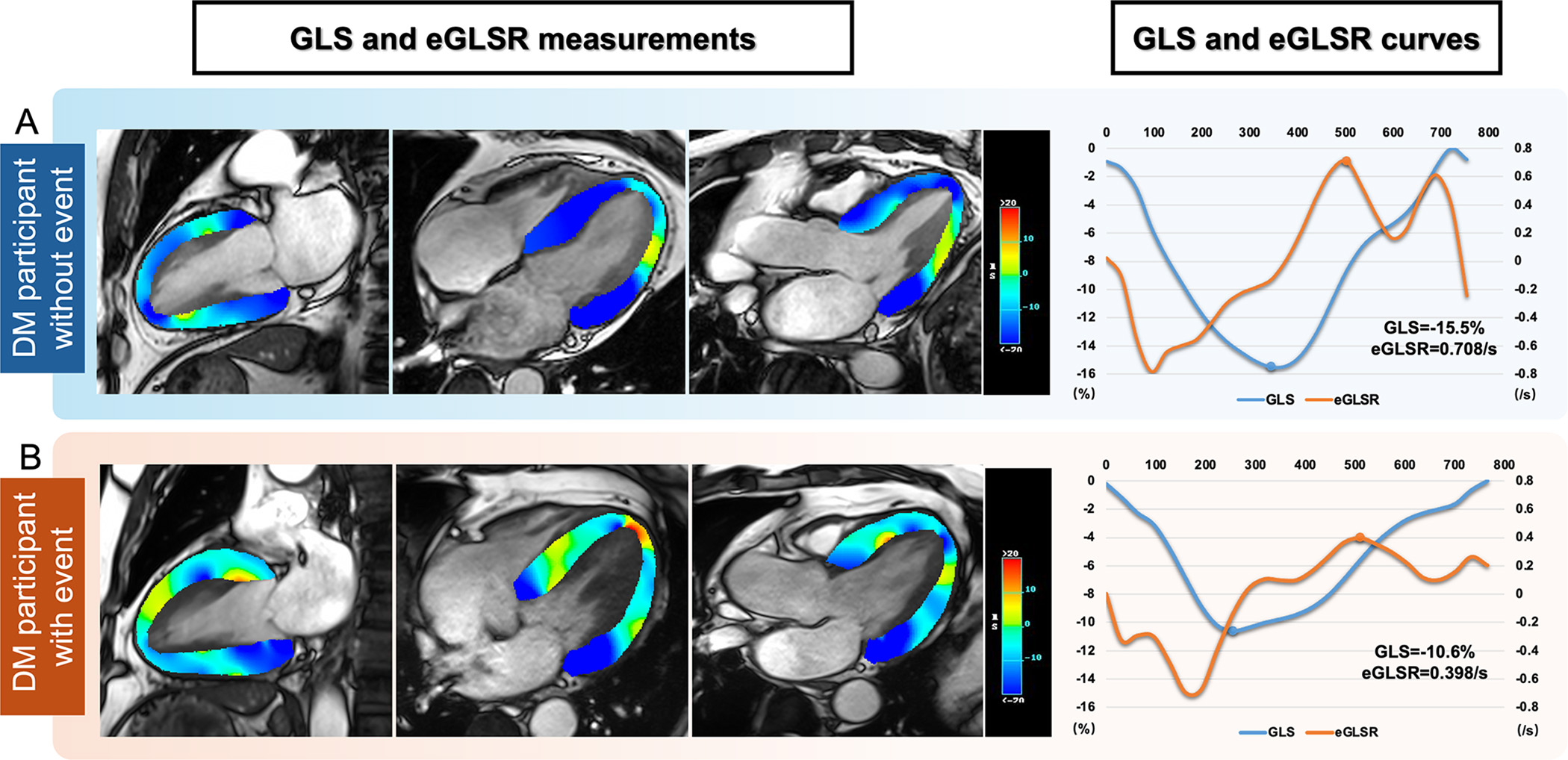Representative cardiac MRI strain images and analysis. Images in the two-, four-, and three-chamber views for strain analysis (left) and left ventricular global longitudinal strain (GLS) and global early diastolic longitudinal strain rate (eGLSR) curves (right) are shown. (A) Example images and GLS and eGLSR curves in a 37-year-old male participant with diabetes mellitus (DM) without events during follow-up after cardiac MRI. (B) Example images and GLS and eGLSR curves in a 45-year-old male participant with DM who had heart failure hospitalization during follow-up after cardiac MRI. In the left images, blue represents higher myocardial strain (higher absolute values of negative strain), whereas red represents reduced strain. In the curves, blue represents GLS, whereas orange represents eGLSR. The left y-axis denotes GLS (%), the right y-axis represents eGLSR (per second), and the x-axis denotes time (milliseconds). For these strain parameters, a lower absolute value indicates more severe myocardial functional impairment; accordingly, GLS and eGLSR were more impaired in participants with events compared with those without events.