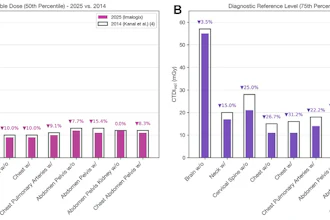 Bar graphs show comparison of volume CT dose index (CTDIvol) (A) achievable doses (50th percentile) and (B) diagnostic reference levels (75th percentile) between 2014 (see reference 4 by Kanal et al) and 2025 (present study) for 10 common CT examination types performed without contrast (w/o) and with contrast (w/). Across all 10 adult CT examination categories, CTDIvol achievable doses and diagnostic reference levels generally decreased from 2014 to 2025, with the largest reductions for torso examinations (chest; abdomen-pelvis; and combined chest, abdomen, and pelvis), intermediate reductions for neck and cervical spine, and minimal change for head examinations.