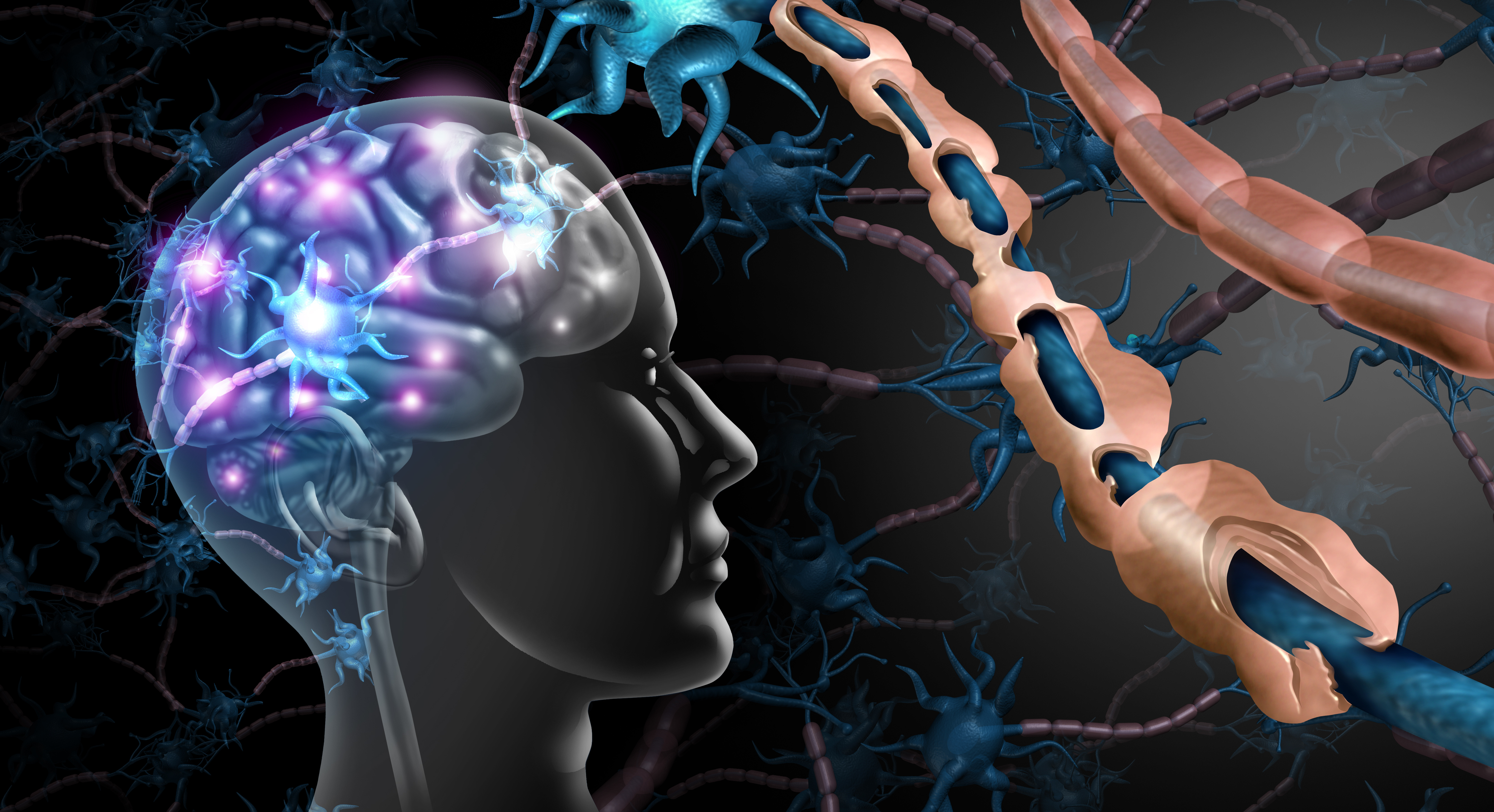 Multiple Sclerosis Nerve Disorder Brain Adobe Freshidea