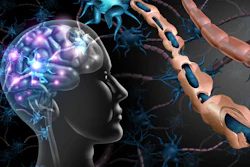 Multiple Sclerosis Nerve Disorder Brain Adobe Freshidea