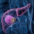 Pancreas Cancerous Area 3 D Rendering Adobe Anton
