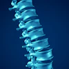 Spine 400