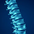 Spine 400