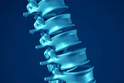 Spine 400