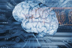 A Ibrain