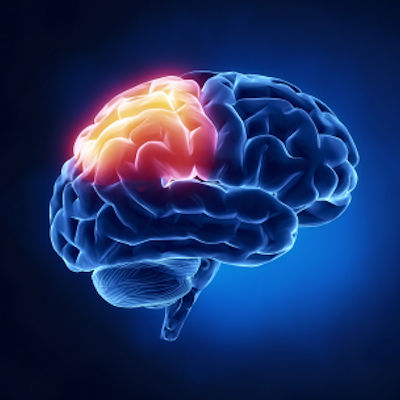 Brain 400