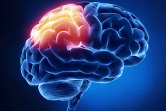 Brain 400