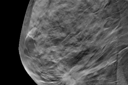 Breast Dbt 400