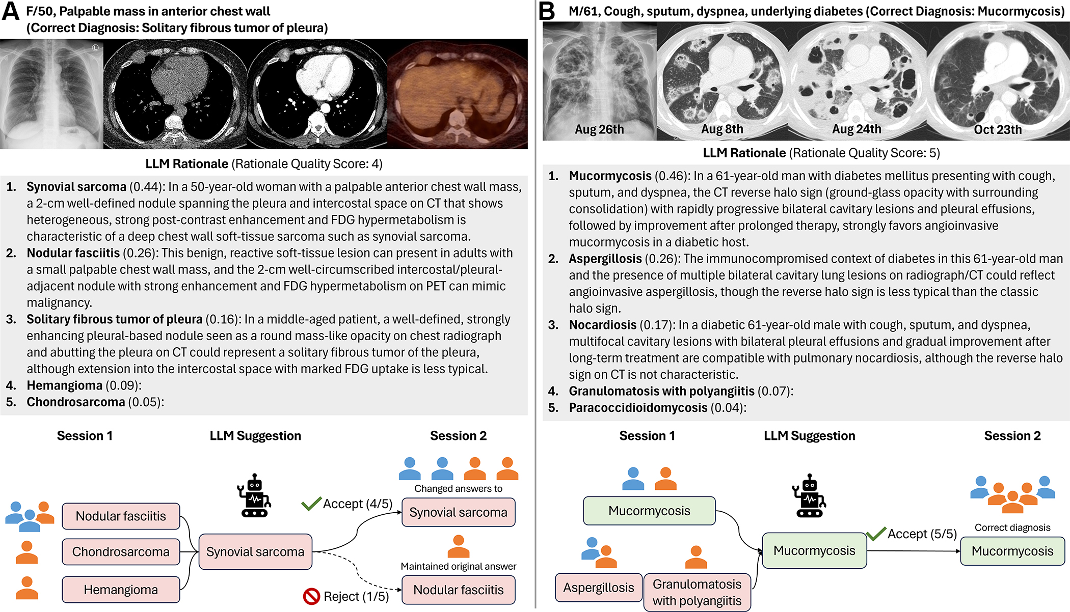 Example cases illustrate the double-edged role of large language model (LLM) rationale quality. (A) A 50-year-old female patient with a palpable anterior chest wall mass (correct diagnosis: solitary fibrous tumor of the pleura). The LLM incorrectly suggested synovial sarcoma but provided a persuasive rationale (quality score: 4 of 5), describing a well-defined nodule at axial contrast-enhanced CT spanning the pleura and intercostal space with heterogeneous strong enhancement. Four of five readers (80%) accepted the incorrect suggestion. FDG = fluorodeoxyglucose. (B) A 61-year-old male patient with diabetes presented with cough, sputum, and dyspnea (correct diagnosis: mucormycosis). The LLM correctly suggested mucormycosis with an excellent rationale (quality score: 5 of 5), integrating the reverse halo sign on serial axial CT images and rapidly progressive cavitary lesions. Three of five readers initially selected incorrect diagnoses; after LLM output, all five selected the correct diagnosis (100% acceptance). Blue and orange reader icons denote high- and low-expertise readers, respectively.
