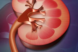Kidney