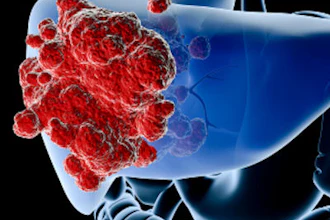 Liver Cancer 400