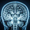 Mri Scan Brain