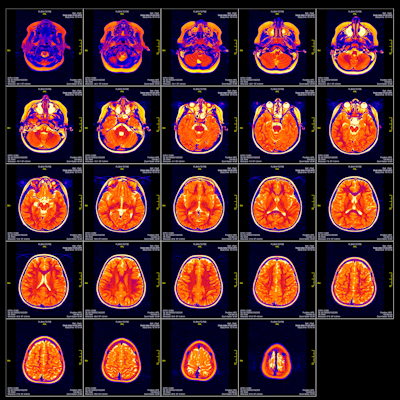 Mri Slide 400
