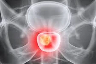 Prostate Imaging