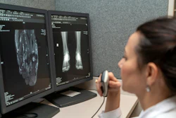 Radiologist Computer Screen X Ray