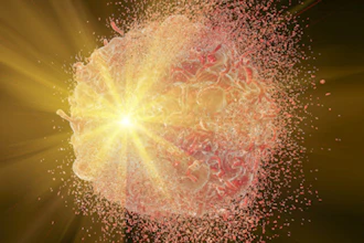Radiotherapy 400