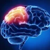 Brain Pet