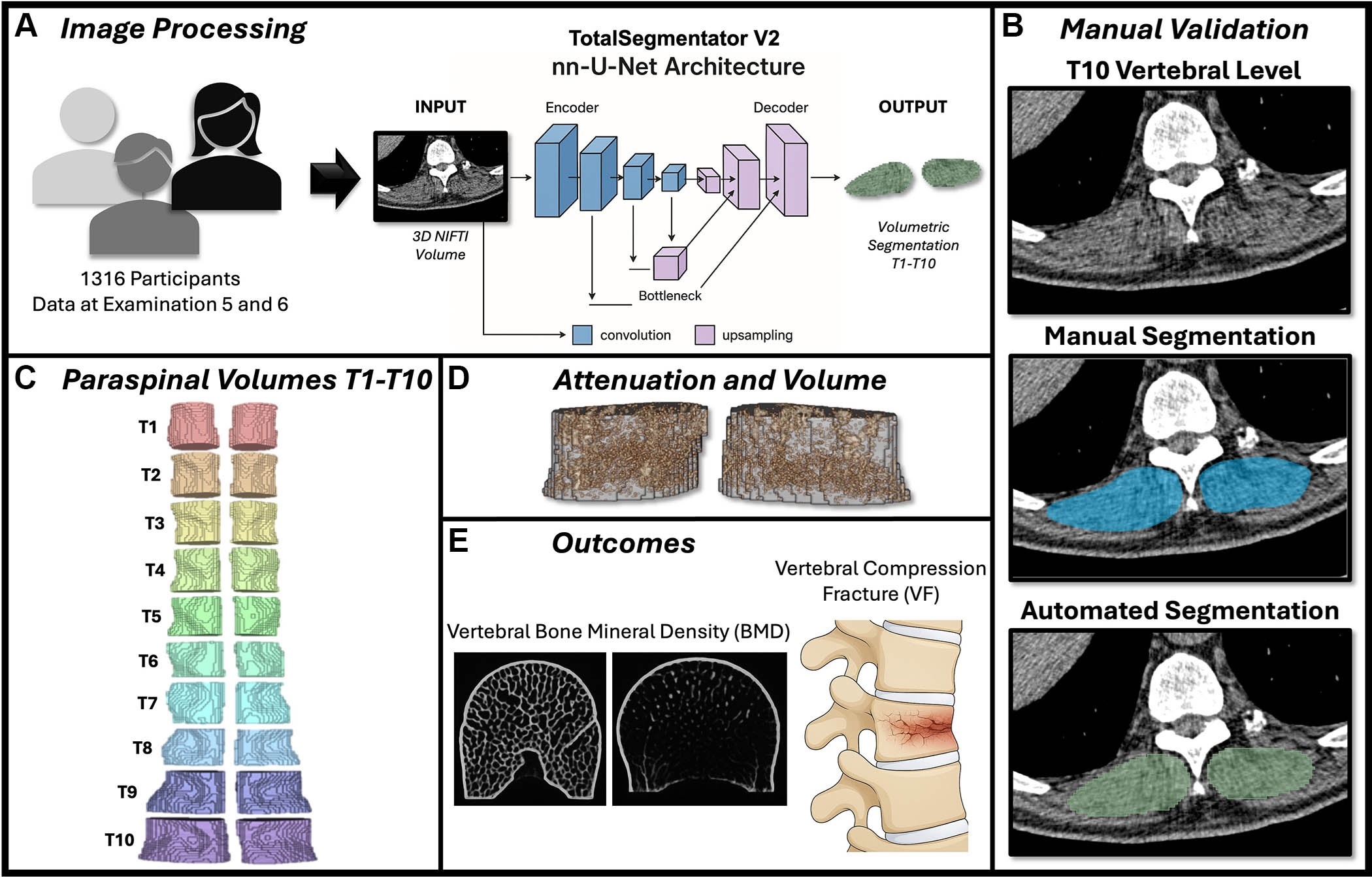 Study overview. (A) Volumetric segmentation of the paraspinal musculature was performed for 1,316 participants. (B) Manual segmentation was performed, the results were compared with the volumetric segmentation results, and the Dice score and the intersection over union were calculated. (C) The three-dimensional segmentations from T1 through T10 were individually extracted and combined into a single volume for analyses. (D) Muscle volume and median muscle attenuation were derived from the segmentation volumes. (E) Analyses were performed to assess the correlation of the paraspinal muscle attenuation and volume with the bone mineral density and the ability to predict vertebral fractures. NIFTI = Neuroimaging Informatics Technology Initiative, 3D = three-dimensional.